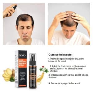 Sprej na urýchlenie rastu vlasov, proti vypadávaniu vlasov, prírodný, unisex, Sevich, 30 ml – Obrázok 8