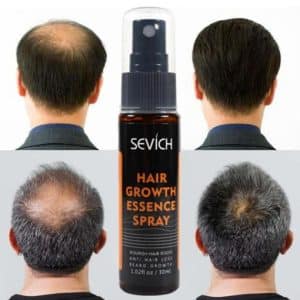Sprej na urýchlenie rastu vlasov, proti vypadávaniu vlasov, prírodný, unisex, Sevich, 30 ml – Obrázok 4
