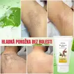 Unisex krém na odstránenie chĺpkov, Aloe Vera a vitamín E, Envisha od Verilaria, 150 ml – Obrázok 2
