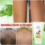 Unisex krém na odstránenie chĺpkov, Aloe Vera a vitamín E, Envisha od Verilaria, 150 ml – Obrázok 5
