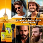 Súprava na rast brady – derma roller a Chebe olej, biotín, hustá a zdravá brada, Sevich – Obrázok 2