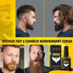 Sada na rast brady – dermaroller, biotín, rozmarín, stimulácia a prírodná výživa, Sevich – Obrázok 4