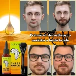 Súprava na rast brady – derma roller a Chebe olej, biotín, hustá a zdravá brada, Sevich – Obrázok 4