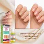 Intenzívna kúra na regeneráciu nechtov, hydratáciu a posilnenie, Verilaria, 10 ml – Obrázok 3