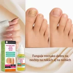 Intenzívna kúra na regeneráciu nechtov, hydratáciu a posilnenie, Verilaria, 10 ml – Obrázok 4