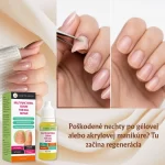 Intenzívna kúra na regeneráciu nechtov, hydratáciu a posilnenie, Verilaria, 10 ml – Obrázok 5