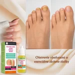 Intenzívna kúra na regeneráciu nechtov, hydratáciu a posilnenie, Verilaria, 10 ml – Obrázok 7