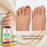 Intenzívna kúra na regeneráciu nechtov, hydratáciu a posilnenie, Verilaria, 10 ml – Obrázok 8